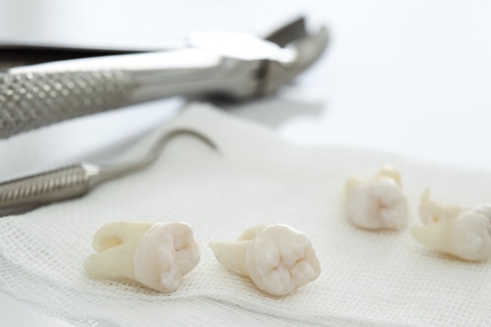 口腔外科 - いけなが歯科（蒲生四丁目駅・大阪市城東区）